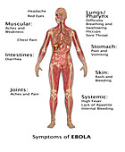 Ebola Virus Symptoms,Illustration