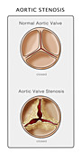 Aortic Valve,Illustration