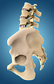 Bones of the Hip,Illustration