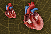 Heart and Hypertrophy,Illustration
