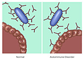 Autoimmune Disease,Illustration
