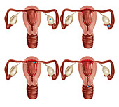 Ovulation and Menstruation,Illustration