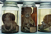 Victims of Agent Orange,Vietnam