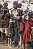 Malnourished by African Drought