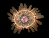 X-ray of Shingle Urchin