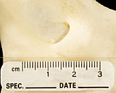Bone Foramen
