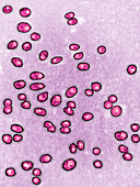 Gonococcus bacteria,LM