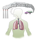 Air Pollution and Lungs,illustration