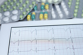 Electrocardiogram and Pills