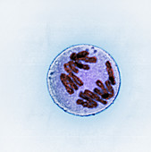 Anaphase of Mitosis in Trillium Cell