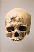 Early Human Skull