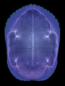 X-ray of a Turtle Shell