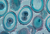 Roundworm Cells in Anaphase,LM