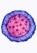 Hepatitis B virus (HBV)