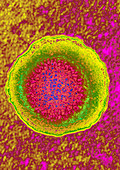 Herpes Simplex Virus (HSV1-HSV2)