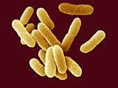 Non-O157:H7 serotype Escherichia coli