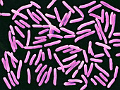 Toxigenic Escherichia coli O45 by SEM