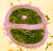 Micrococcus lysodelkticus,TEM