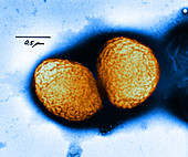 Neisseria gonorrhoeae,TEM