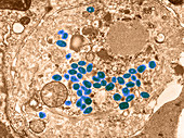 Smallpox virus,TEM