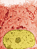 TEM of Epididymis