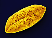 Aloe vera Pollen,SEM