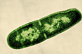 Fission in Bacillus licheniformis (TEM)