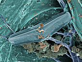 Diatom with Thermophilic Bacteria