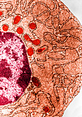 Plasma Cell Protein Storage,TEM