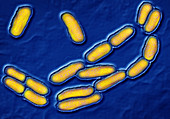 Escherichia coli bacterium