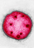 Arenavirus