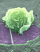 Macrophage (SEM)