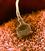 Human Sperm Fertilizing Hamster Egg (SEM)