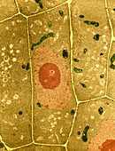 Root Cells of Plant,TEM