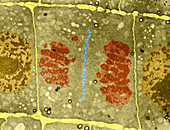 Mitosis in Plant Cell,TEM