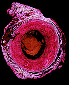 Light Micrograph of Carotid Artery
