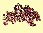 Mycoplasma Bacteria,TEM