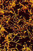 Spiroplasma Bacteria,SEM