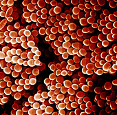 Staphylococcus Aureus,SEM