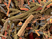 Toddler's Feces with Bifidobacteria,SEM