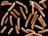 Toxigenic Escherichia coli O145,SEM