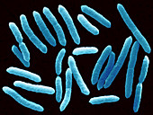 Toxigenic Escherichia coli O145,SEM