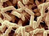 Salmonella Enteritidis Bacteria,SEM
