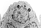 Alveolar cell,TEM