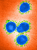 Infectious Bronchitis Virus,TEM
