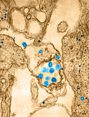 HCoV-229E,Human Coronavirus,TEM