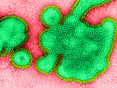 H3N2 Influenza Virus,TEM