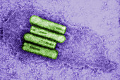 Broccoli Necrotic Yellow Virus,TEM