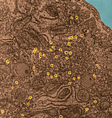 Lipoprotein Synthesis,TEM