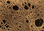 Cytoskeleton of Tissue Culture Cells,TEM